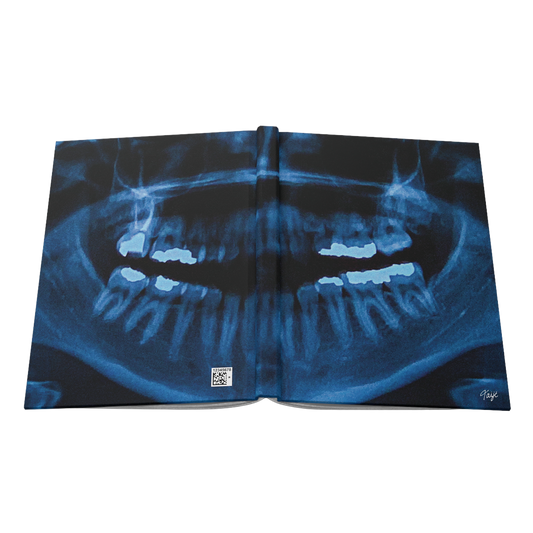 "NOVOCAINE" (2019) Hardcover Journal