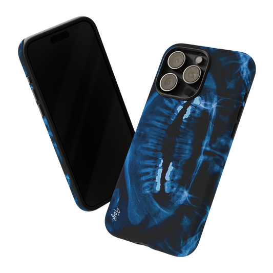 "NOVOCAINE" (2019) Tough Phone Case