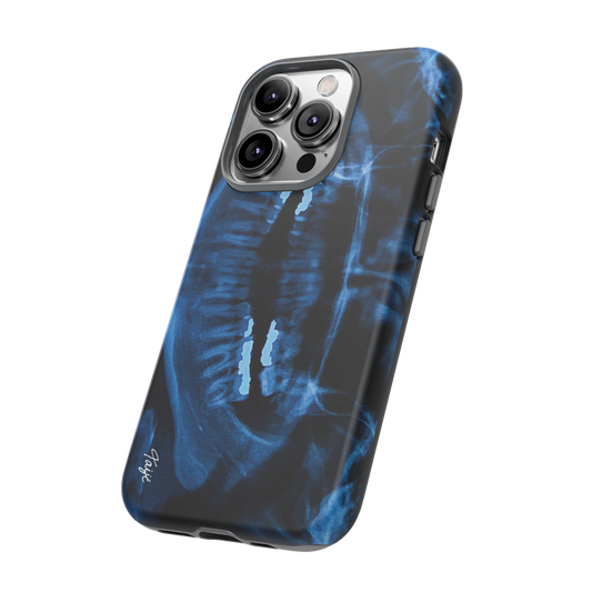 "NOVOCAINE" (2019) Tough Phone Case