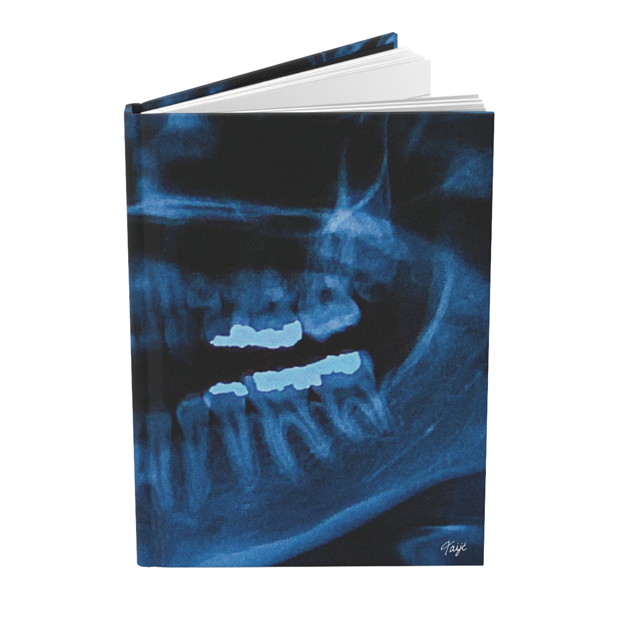 "NOVOCAINE" (2019) Hardcover Journal