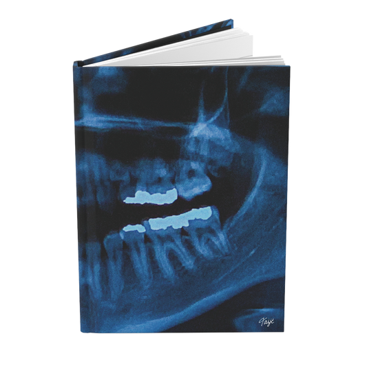 "NOVOCAINE" (2019) Hardcover Journal