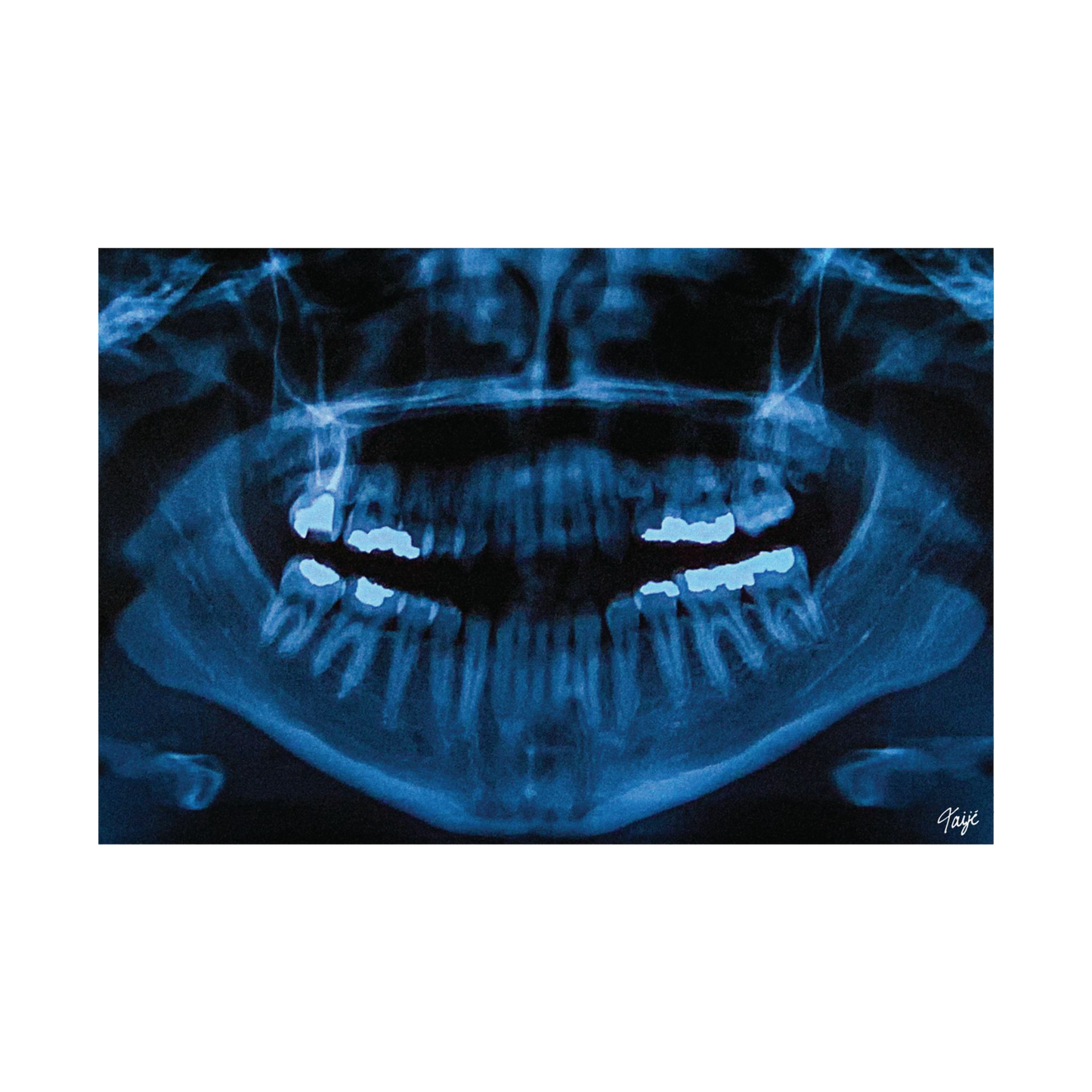 "NOVOCAINE" (2019) Satin Poster