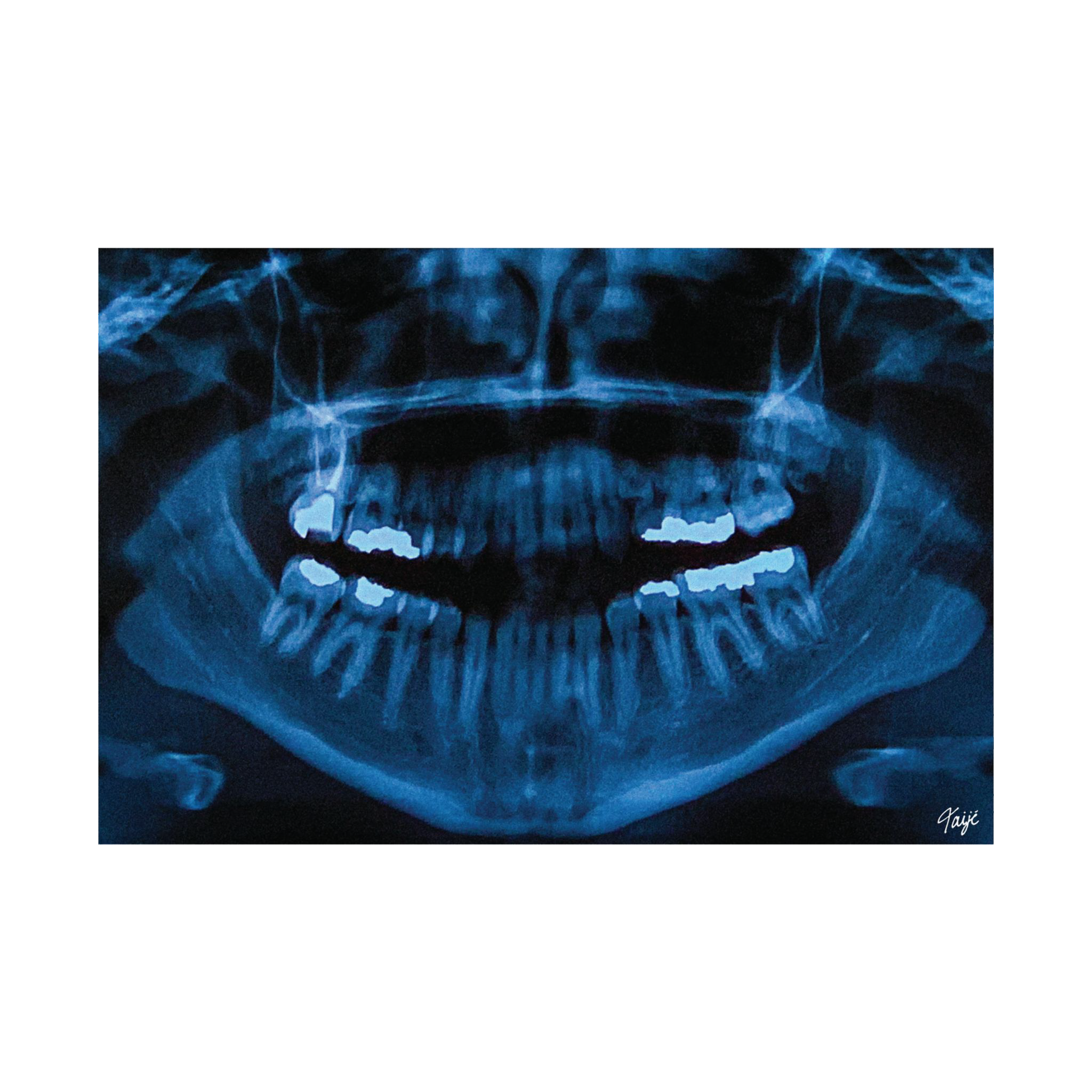 "NOVOCAINE" (2019) Satin Poster