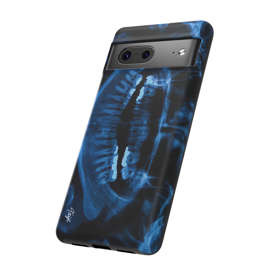 "NOVOCAINE" (2019) Tough Phone Case